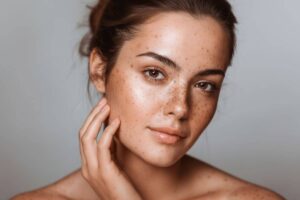 How to Remove Dark Spot on Face Naturally at Home